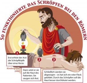 Kindergrafik: Wie funktionierte das Schröpfen bei den Römern? (09.01.2015)
